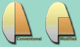 Modification of Rudder Planform